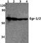 Early Growth Response 2 antibody, NB100-92327, Novus Biologicals, Western Blot image 
