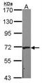 Carnitine O-Acetyltransferase antibody, NBP2-15999, Novus Biologicals, Western Blot image 