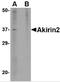 Akirin 2 antibody, 4803, ProSci Inc, Western Blot image 