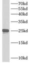 Ankyrin Repeat Domain 39 antibody, FNab00413, FineTest, Western Blot image 