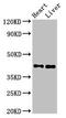 Malonyl-CoA-acyl carrier protein transacylase, mitochondrial antibody, LS-C672106, Lifespan Biosciences, Western Blot image 