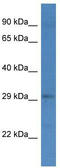 Guided Entry Of Tail-Anchored Proteins Factor 4 antibody, TA343126, Origene, Western Blot image 