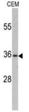 Paired box protein Pax-4 antibody, AP17621PU-N, Origene, Western Blot image 