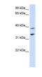 Solute Carrier Family 25 Member 34 antibody, NBP1-59607, Novus Biologicals, Western Blot image 
