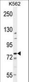 B-cell lymphoma/leukemia 11B antibody, LS-C156770, Lifespan Biosciences, Western Blot image 