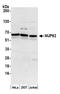 Nuclear pore glycoprotein p62 antibody, A304-941A, Bethyl Labs, Western Blot image 