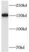 Structural maintenance of chromosomes protein 4 antibody, FNab08018, FineTest, Western Blot image 