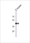 ATF4 antibody, LS-C204011, Lifespan Biosciences, Western Blot image 