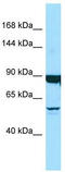 Dynein Axonemal Heavy Chain 9 antibody, TA338182, Origene, Western Blot image 