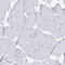 HMW Cytokeratin antibody, HPA030877, Atlas Antibodies, Immunohistochemistry frozen image 