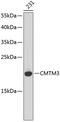 CKLF Like MARVEL Transmembrane Domain Containing 3 antibody, 18-878, ProSci, Western Blot image 