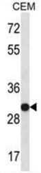 Small Nuclear Ribonucleoprotein Polypeptide A antibody, AP53964PU-N, Origene, Western Blot image 
