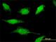 Calcium/Calmodulin Dependent Protein Kinase ID antibody, H00057118-M10, Novus Biologicals, Immunofluorescence image 
