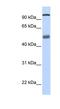 Putative pre-mRNA-splicing factor ATP-dependent RNA helicase DHX32 antibody, NBP1-57347, Novus Biologicals, Western Blot image 