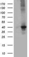 Uridine Phosphorylase 2 antibody, CF812317, Origene, Western Blot image 