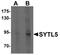 Synaptotagmin Like 5 antibody, A12927, Boster Biological Technology, Western Blot image 