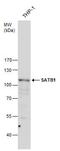 DNA-binding protein SATB1 antibody, PA5-30162, Invitrogen Antibodies, Western Blot image 