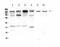 Insulin Like Growth Factor 2 Receptor antibody, A00951, Boster Biological Technology, Western Blot image 