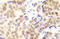 Histone Deacetylase 1 antibody, AP20947PU-N, Origene, Immunohistochemistry frozen image 