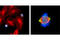 Aurora Kinase A antibody, 2914S, Cell Signaling Technology, Immunocytochemistry image 