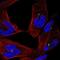 Centrosomal Protein 290 antibody, NBP2-57104, Novus Biologicals, Immunofluorescence image 