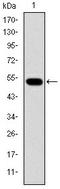 Glucokinase antibody, AM06654SU-N, Origene, Western Blot image 