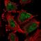 ATR Serine/Threonine Kinase antibody, NBP2-76547, Novus Biologicals, Immunofluorescence image 