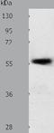 Solute carrier family 22 member 17 antibody, TA322261, Origene, Western Blot image 