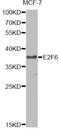 E2F Transcription Factor 6 antibody, LS-C746823, Lifespan Biosciences, Western Blot image 