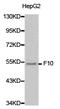 Coagulation Factor X antibody, LS-C192769, Lifespan Biosciences, Western Blot image 