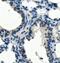 Histone-lysine N-methyltransferase SETD1A antibody, A03736-1, Boster Biological Technology, Immunohistochemistry paraffin image 
