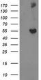 Glucosylceramidase Beta 3 (Gene/Pseudogene) antibody, CF502605, Origene, Western Blot image 