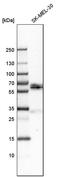 GBA antibody, PA5-52319, Invitrogen Antibodies, Western Blot image 