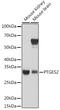 Prostaglandin E Synthase 2 antibody, GTX33444, GeneTex, Western Blot image 