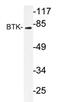 Bruton Tyrosine Kinase antibody, AP20276PU-N, Origene, Western Blot image 