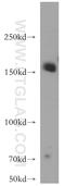 Enhancer of mRNA-decapping protein 4 antibody, 17737-1-AP, Proteintech Group, Western Blot image 