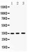NK2 Homeobox 5 antibody, PB9293, Boster Biological Technology, Western Blot image 