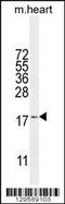 Small Nuclear Ribonucleoprotein U4/U6.U5 Subunit 27 antibody, 56-098, ProSci, Western Blot image 
