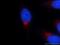 Golgi SNAP Receptor Complex Member 2 antibody, 12095-1-AP, Proteintech Group, Immunofluorescence image 