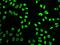Small Nuclear Ribonucleoprotein Polypeptide A antibody, GTX55804, GeneTex, Immunocytochemistry image 