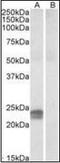 High mobility group protein HMG-I/HMG-Y antibody, orb89328, Biorbyt, Western Blot image 
