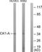 Casein Kinase 1 Alpha 1 antibody, TA313700, Origene, Western Blot image 