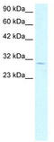 Cyclin Dependent Kinase 4 antibody, TA330308, Origene, Western Blot image 