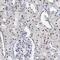 Small nuclear ribonucleoprotein Sm D1 antibody, NBP2-36427, Novus Biologicals, Immunohistochemistry paraffin image 