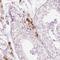 Leukocyte Cell Derived Chemotaxin 2 antibody, NBP2-37907, Novus Biologicals, Immunohistochemistry paraffin image 