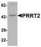 Proline-rich transmembrane protein 2 antibody, A02707, Boster Biological Technology, Western Blot image 