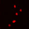 Probable ATP-dependent RNA helicase DDX5 antibody, LS-C358965, Lifespan Biosciences, Immunofluorescence image 