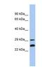 NSE2 (MMS21) Homolog, SMC5-SMC6 Complex SUMO Ligase antibody, NBP1-56293, Novus Biologicals, Western Blot image 