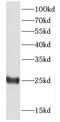 D-Aminoacyl-TRNA Deacylase 1 antibody, FNab02548, FineTest, Western Blot image 