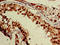 Zinc Finger Protein 331 antibody, orb400252, Biorbyt, Immunohistochemistry paraffin image 